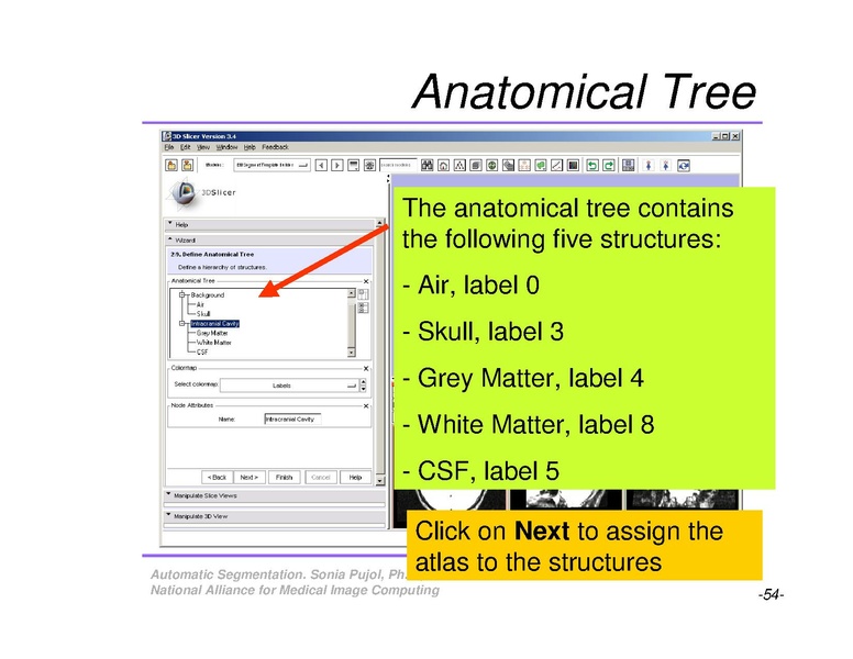 File:AutomaticSegmentation SoniaPujol.pdf