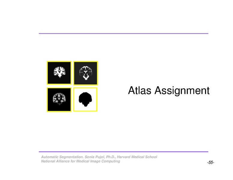 File:AutomaticSegmentation SoniaPujol.pdf