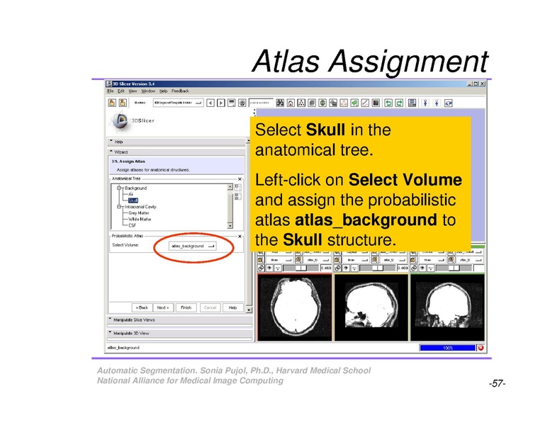 File:AutomaticSegmentation SoniaPujol.pdf