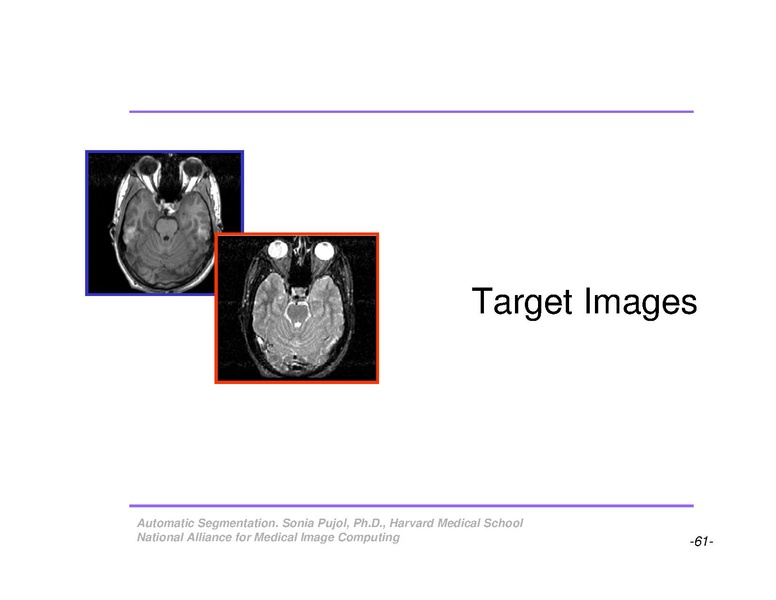 File:AutomaticSegmentation SoniaPujol.pdf