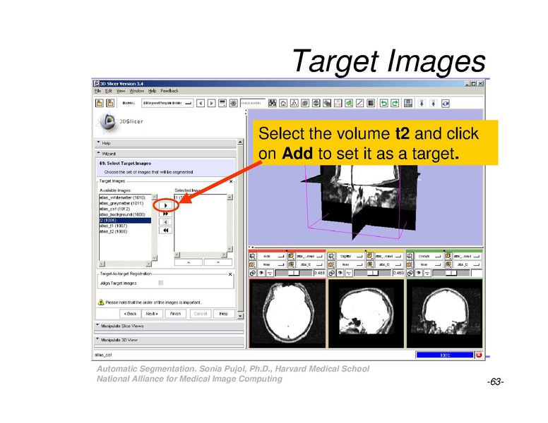 File:AutomaticSegmentation SoniaPujol.pdf