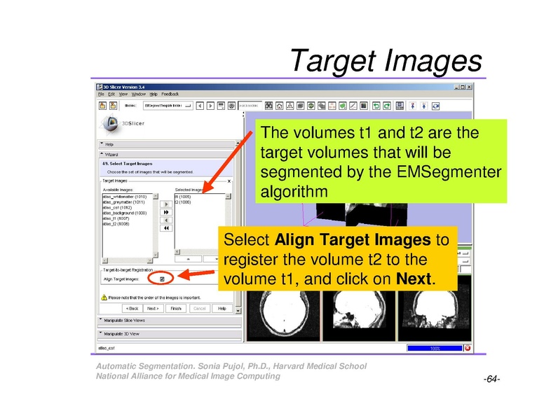 File:AutomaticSegmentation SoniaPujol.pdf