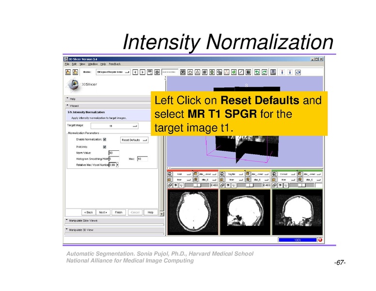 File:AutomaticSegmentation SoniaPujol.pdf