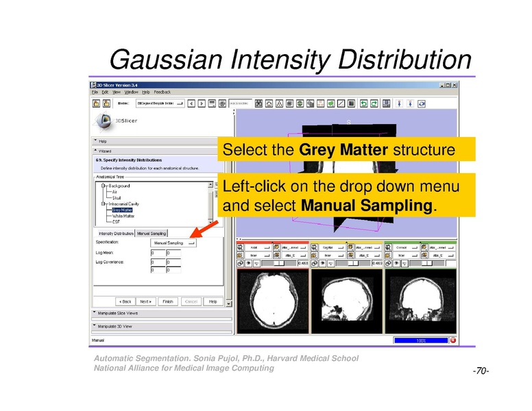 File:AutomaticSegmentation SoniaPujol.pdf