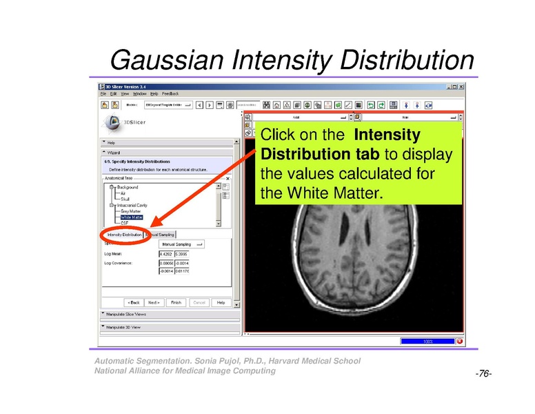 File:AutomaticSegmentation SoniaPujol.pdf