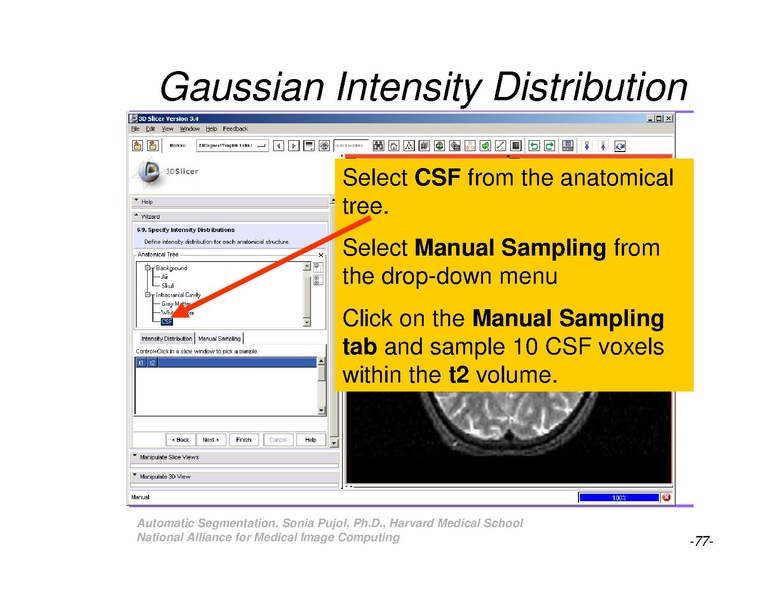 File:AutomaticSegmentation SoniaPujol.pdf