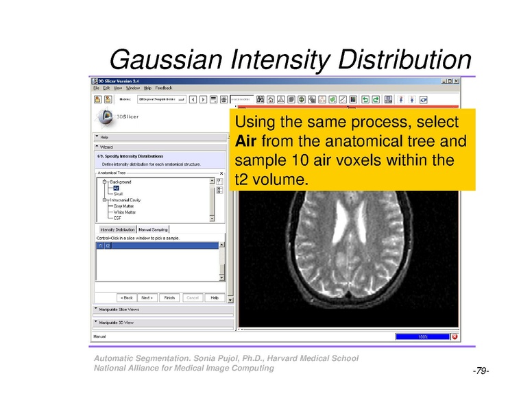 File:AutomaticSegmentation SoniaPujol.pdf