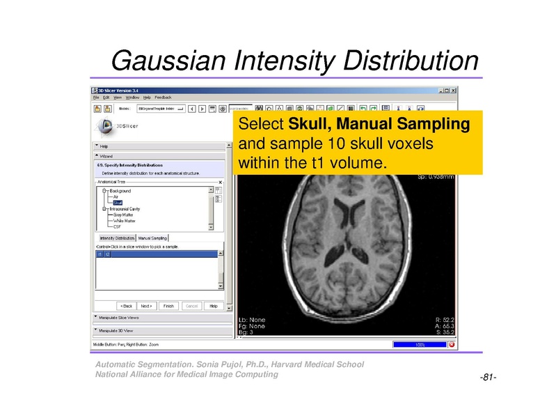 File:AutomaticSegmentation SoniaPujol.pdf