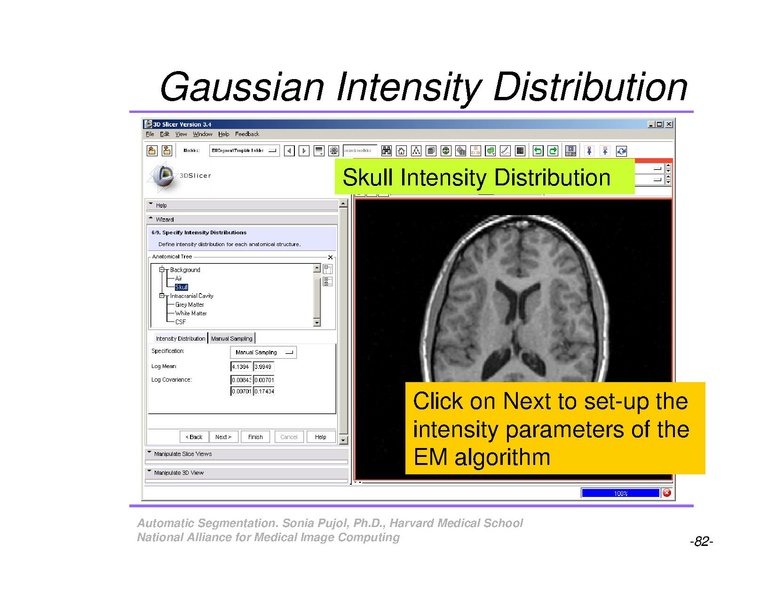 File:AutomaticSegmentation SoniaPujol.pdf
