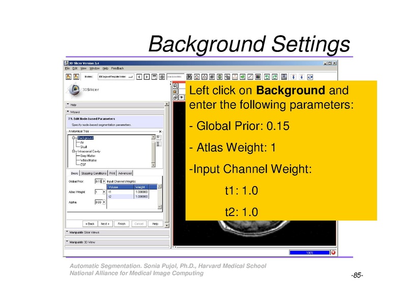 File:AutomaticSegmentation SoniaPujol.pdf