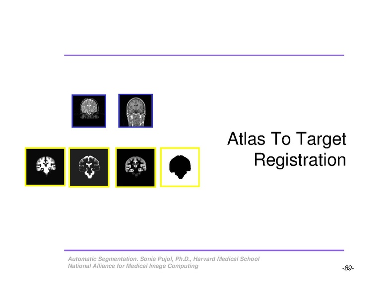 File:AutomaticSegmentation SoniaPujol.pdf