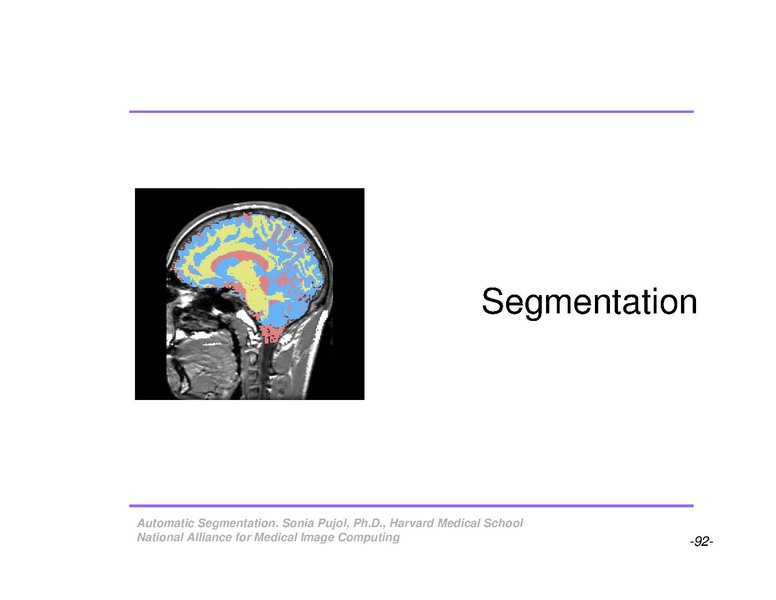 File:AutomaticSegmentation SoniaPujol.pdf