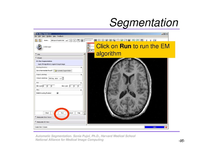 File:AutomaticSegmentation SoniaPujol.pdf