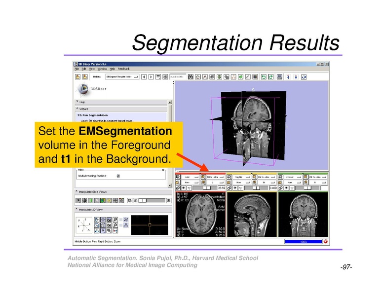 File:AutomaticSegmentation SoniaPujol.pdf