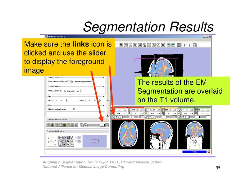 File:AutomaticSegmentation SoniaPujol.pdf