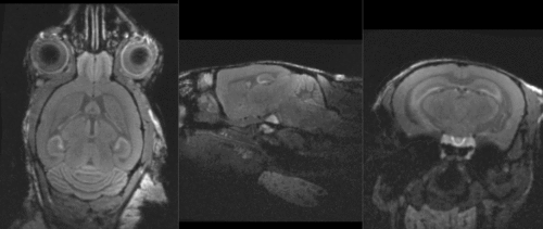 registered brains after 5x5x5 nonrigid BSpline alignment