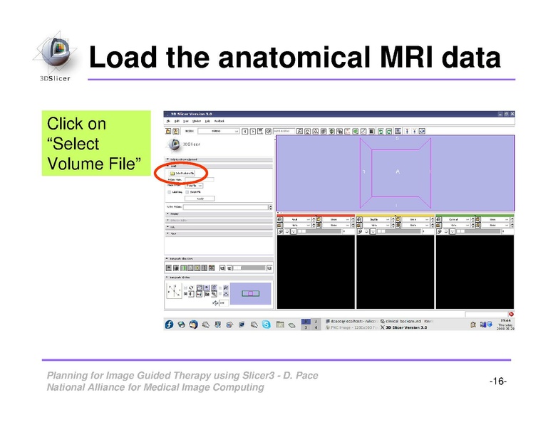 File:ImageGuidedTherapyPlanning.pdf