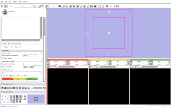 Modules:NeuroNav-Documentation-3.6 - Slicer Wiki