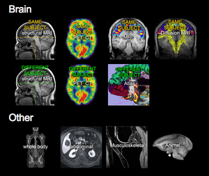 The Slicer Registration Case Library