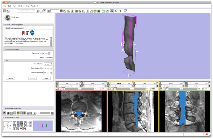 Modules:SpineSegmentation-Documentation-3.6 - Slicer Wiki