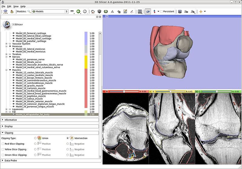 File:Slicer4-Models-KneeAtlas.jpeg