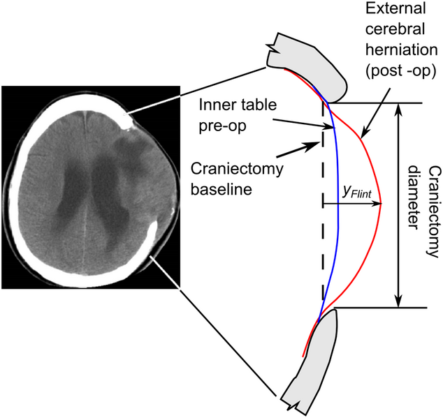 File:Fletcher-PLosOne2014-fig1.png