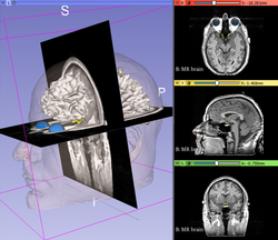 20180426 DataLoadingAndVisualizationTutorial.png