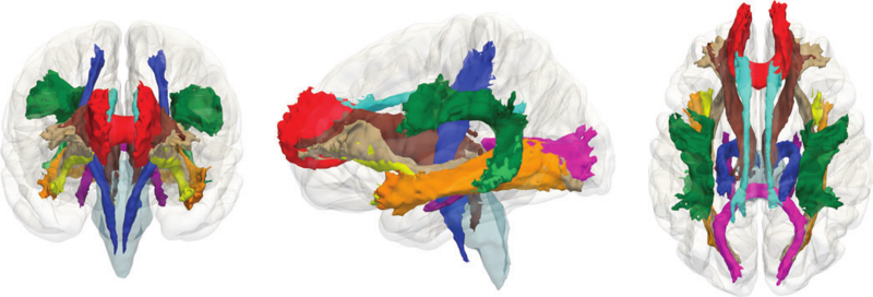 File:Tamnes-CerebCortex2010-fig2.png