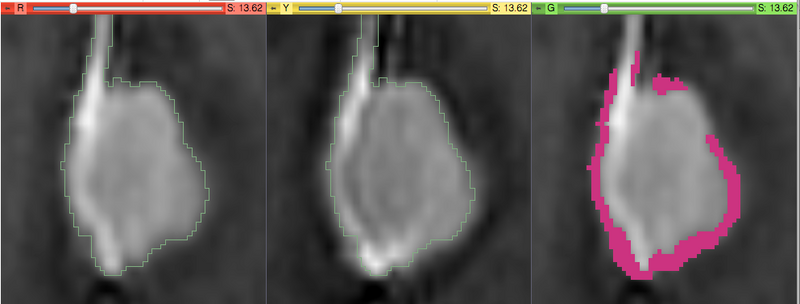File:Slicer4 IntensityDifferenceMetric.png