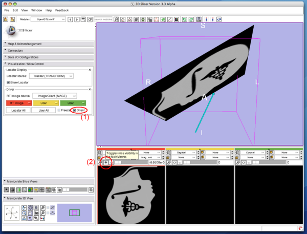 Slicer3 OpenIGTLinkIF ImagePlaneSetting4.png