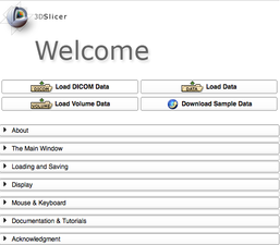 Documentation/4.0/Announcements - Slicer Wiki