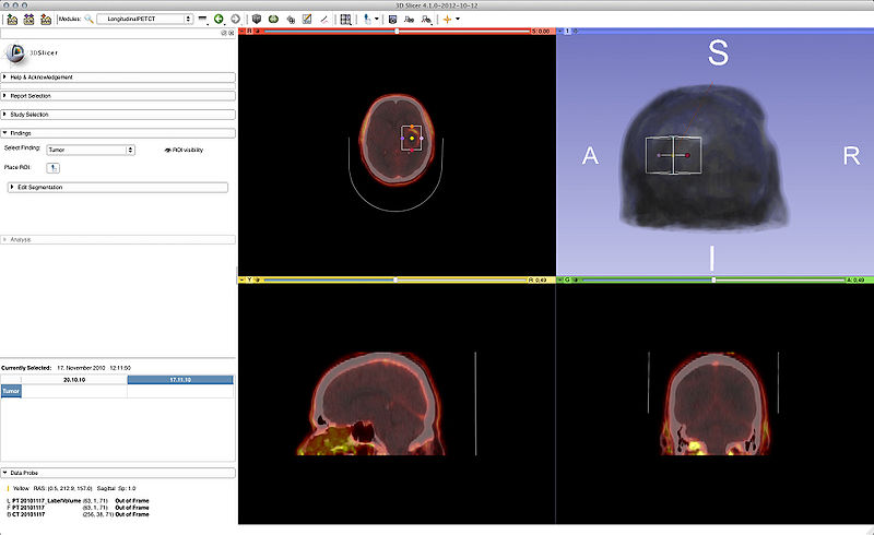 File:LongitudinalPETCT Screenshot.jpg