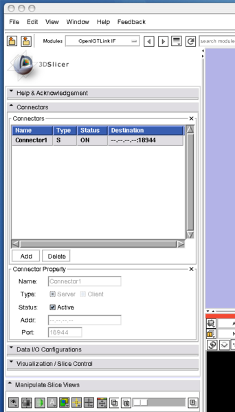 File:Slicer3 OpenIGTLinkIF Server connected.png