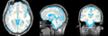 MRI-Human-Brain-Parcellation.png