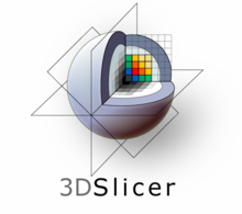 WelcomeToSlicer-2016-05-31.jpg