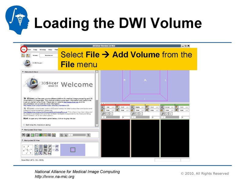 File:DiffusionMRITutorial UCSF2010 SoniaPujol.pdf