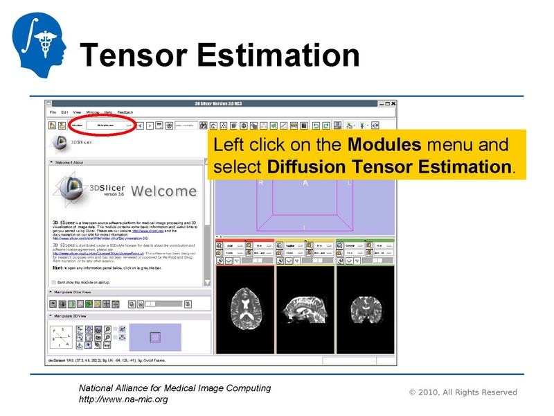 File:DiffusionMRITutorial UCSF2010 SoniaPujol.pdf