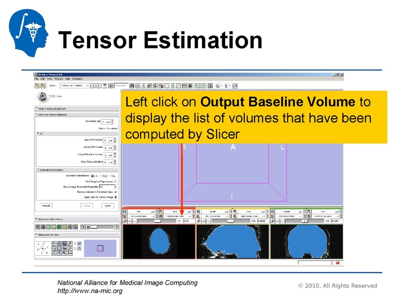 File:DiffusionMRITutorial UCSF2010 SoniaPujol.pdf