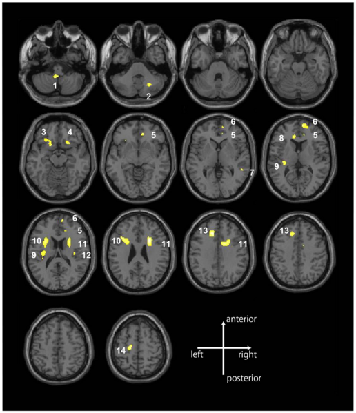 File:Konishi-PLosOne2014-fig1.png