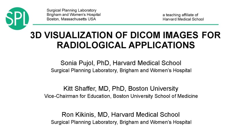 File:3DVisualizationDICOM SoniaPujol.pdf