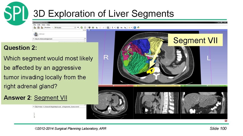 File:3DVisualizationDICOM SoniaPujol.pdf
