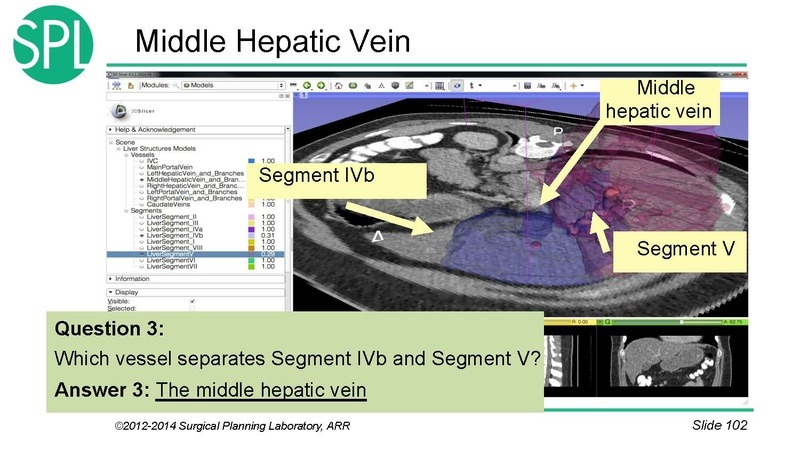File:3DVisualizationDICOM SoniaPujol.pdf