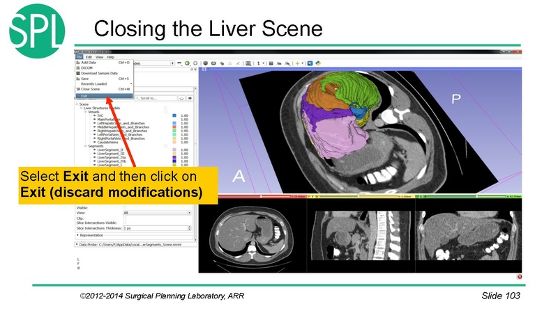 File:3DVisualizationDICOM SoniaPujol.pdf