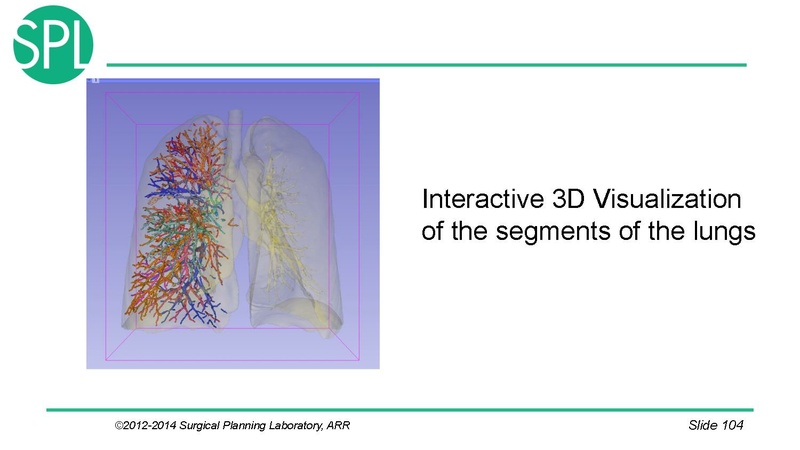 File:3DVisualizationDICOM SoniaPujol.pdf