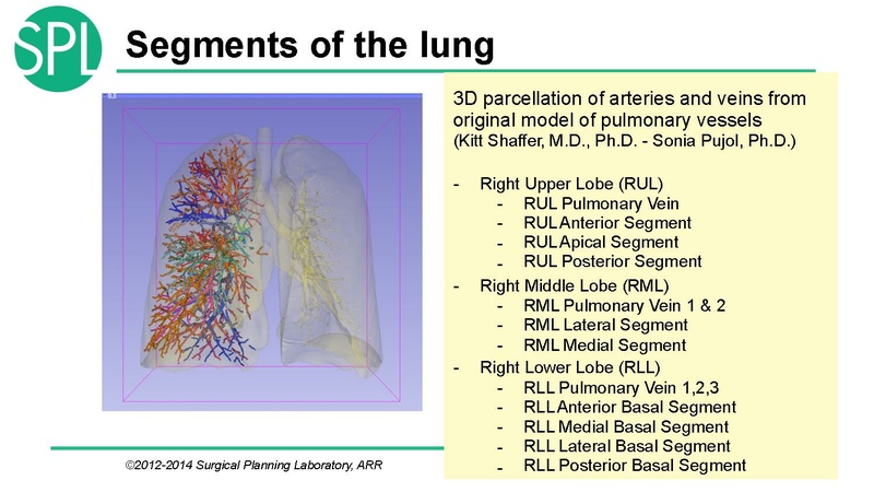 File:3DVisualizationDICOM SoniaPujol.pdf