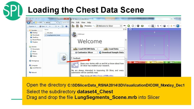 File:3DVisualizationDICOM SoniaPujol.pdf
