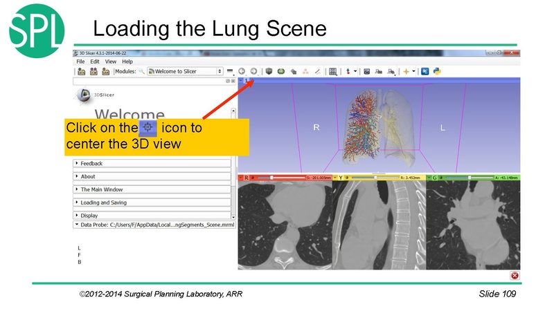 File:3DVisualizationDICOM SoniaPujol.pdf