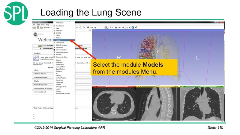File:3DVisualizationDICOM SoniaPujol.pdf