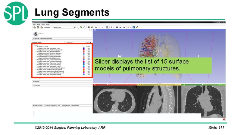 File:3DVisualizationDICOM SoniaPujol.pdf