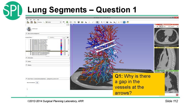 File:3DVisualizationDICOM SoniaPujol.pdf